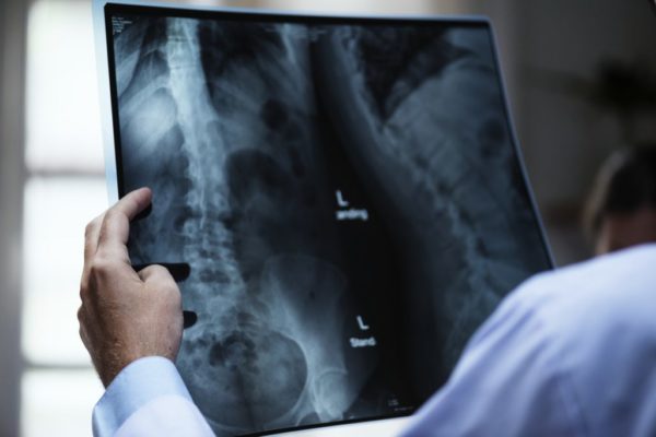 chronic pain chiropractor