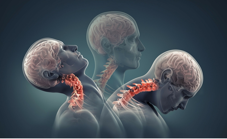 Whiplash Chiropractor